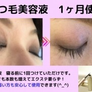 たった１～2ヶ月でまつ毛がフサフサ！敏感肌でも...